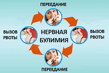 Лечение булимии в Онеге